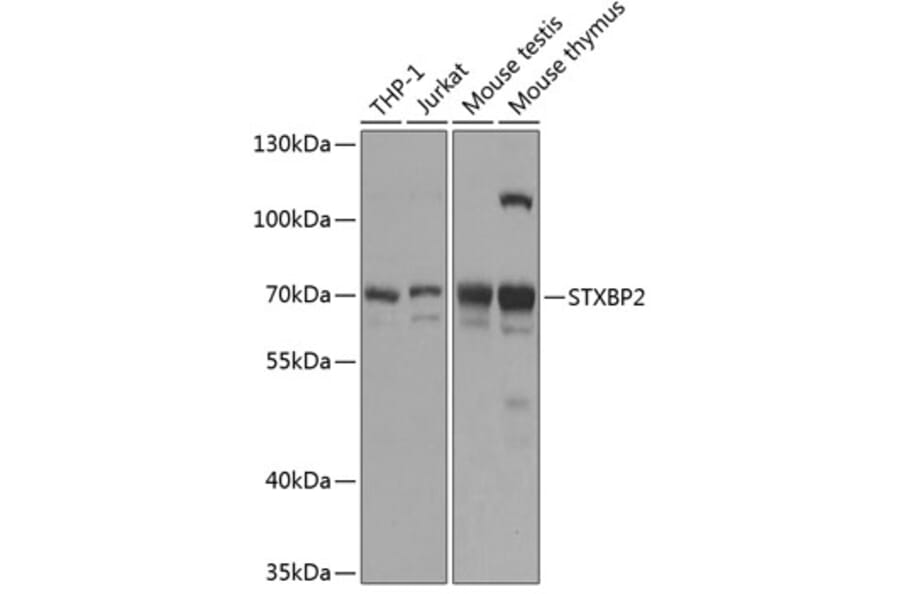 Western Blot - Anti-Munc18-2 Antibody (A90865) - Antibodies.com