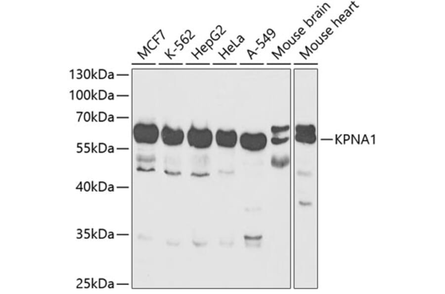 Western Blot - Anti-KPNA1 Antibody (A90866) - Antibodies.com