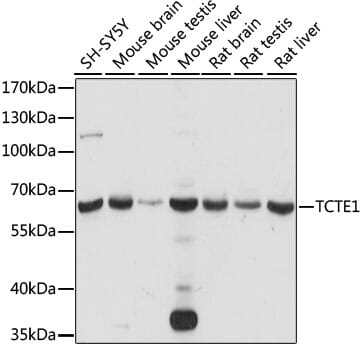 Western blot analysis of extracts of various cell lines, using Anti-TCTE1 Antibody (A15216) at 1:1,000 dilution.
Secondary antibody: Goat Anti-Rabbit IgG (H+L) (HRP) (AS014) at 1:10,000 dilution.
Lysates / proteins: 25µg per lane.
Blocking buffer: 3% non-fat dry milk in TBST.
Detection: ECL Basic Kit (RM00020).
Exposure time: 15s.