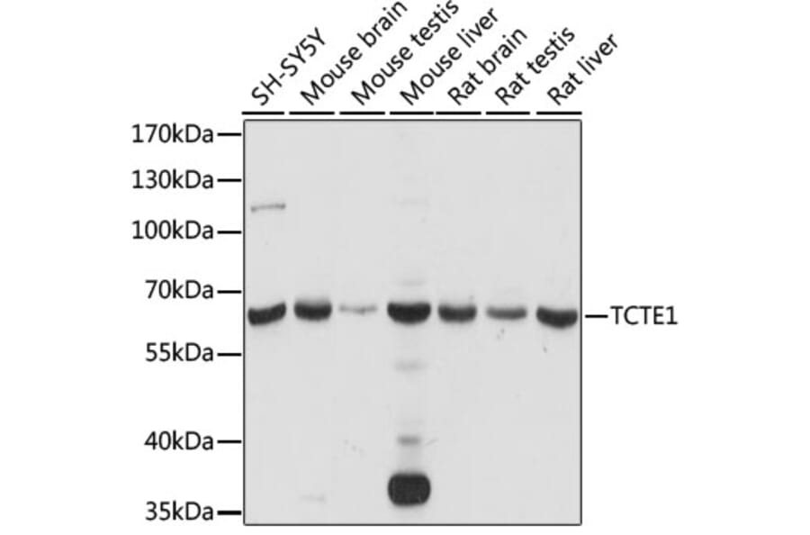 Western Blot - Anti-TCTE1 Antibody (A90867) - Antibodies.com