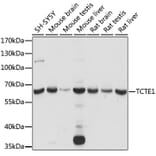 Western Blot - Anti-TCTE1 Antibody (A90867) - Antibodies.com