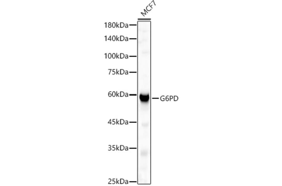 Western Blot - Anti-Glucose 6 Phosphate Dehydrogenase Antibody (A90868) - Antibodies.com