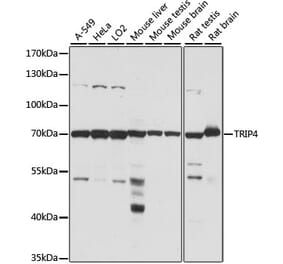 Western Blot - Anti-ASC1 Antibody (A90869) - Antibodies.com