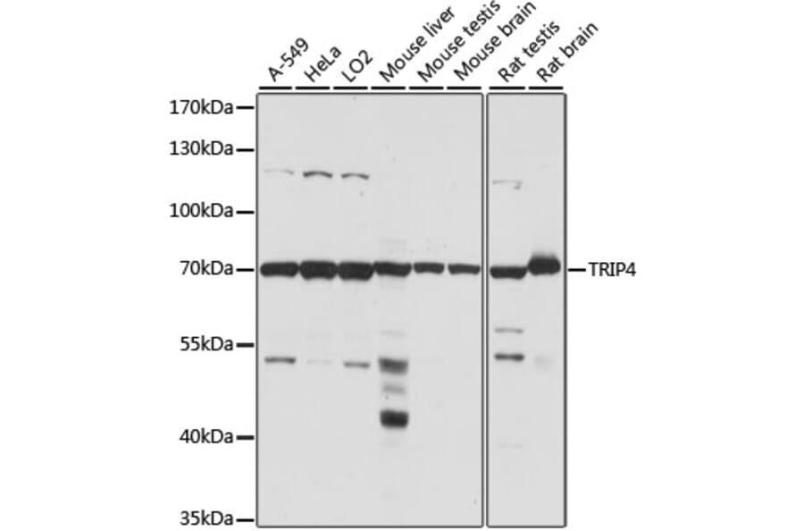 Western Blot - Anti-ASC1 Antibody (A90869) - Antibodies.com