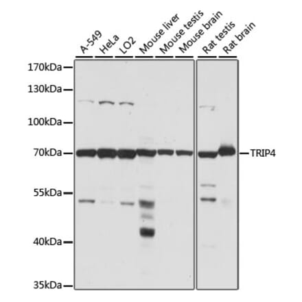 Western Blot - Anti-ASC1 Antibody (A90869) - Antibodies.com