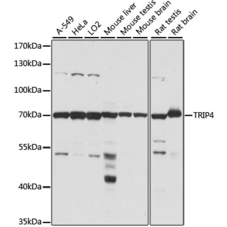 Western Blot - Anti-ASC1 Antibody (A90869) - Antibodies.com