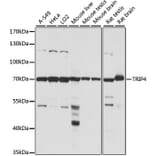 Western Blot - Anti-ASC1 Antibody (A90869) - Antibodies.com