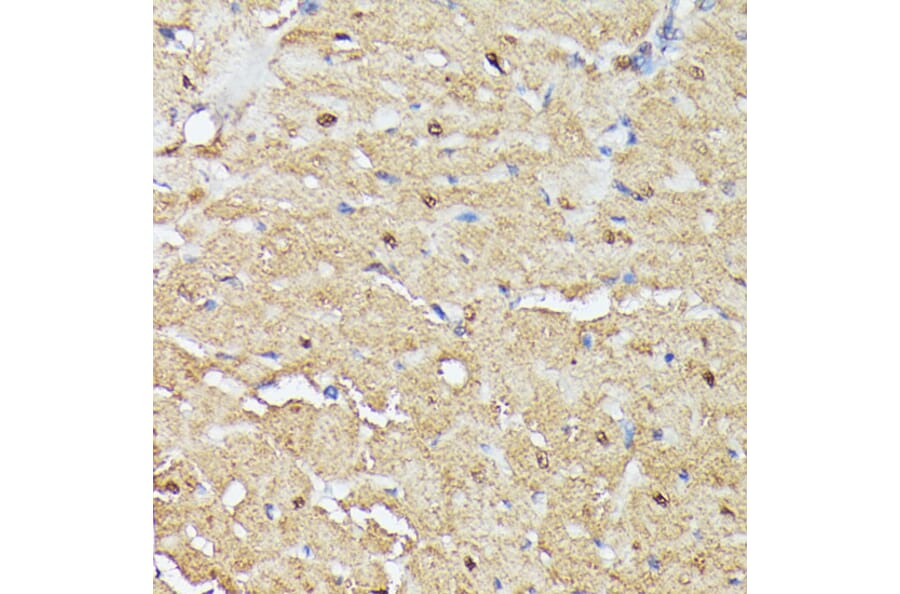 Immunohistochemistry - Anti-ASC1 Antibody (A90869) - Antibodies.com