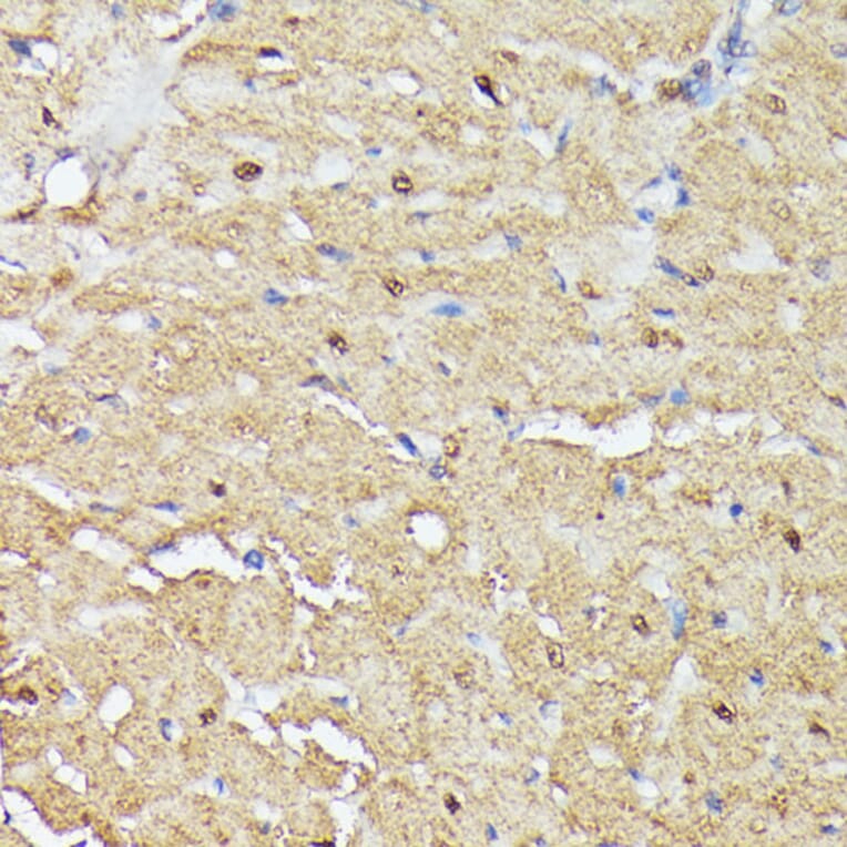 Immunohistochemistry - Anti-ASC1 Antibody (A90869) - Antibodies.com