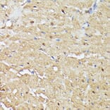 Immunohistochemistry - Anti-ASC1 Antibody (A90869) - Antibodies.com