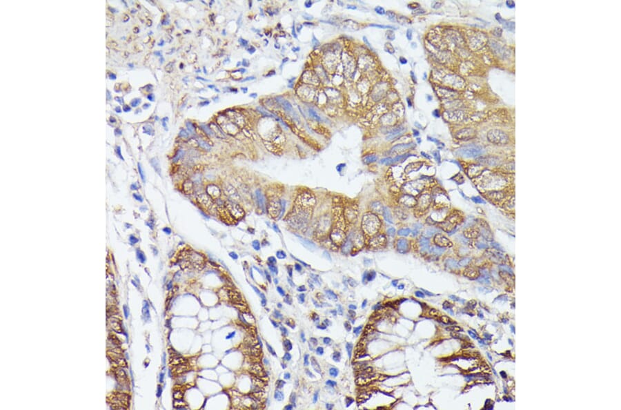 Immunohistochemistry - Anti-ASC1 Antibody (A90869) - Antibodies.com