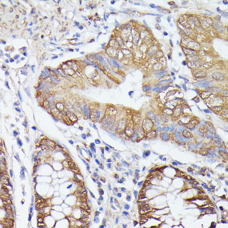 Immunohistochemistry - Anti-ASC1 Antibody (A90869) - Antibodies.com