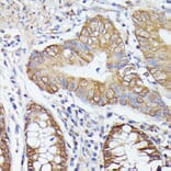 Immunohistochemistry - Anti-ASC1 Antibody (A90869) - Antibodies.com