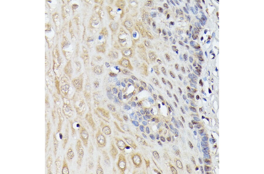 Immunohistochemistry - Anti-ASC1 Antibody (A90869) - Antibodies.com