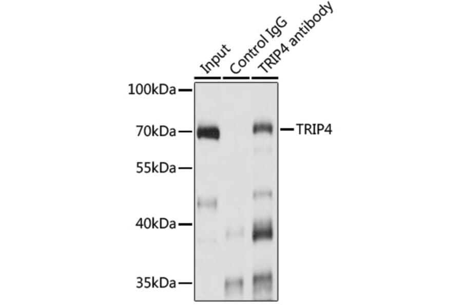 Western Blot - Anti-ASC1 Antibody (A90869) - Antibodies.com