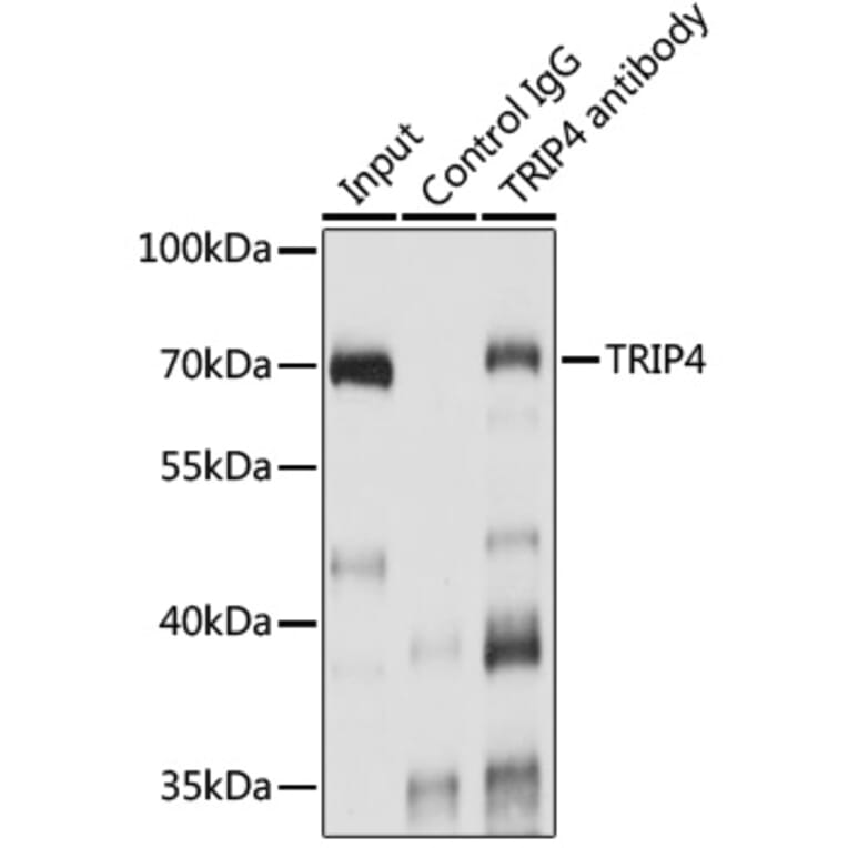 Western Blot - Anti-ASC1 Antibody (A90869) - Antibodies.com