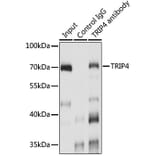 Western Blot - Anti-ASC1 Antibody (A90869) - Antibodies.com