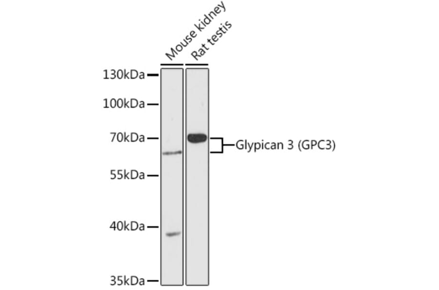 Western Blot - Anti-Glypican 3 Antibody (A90870) - Antibodies.com