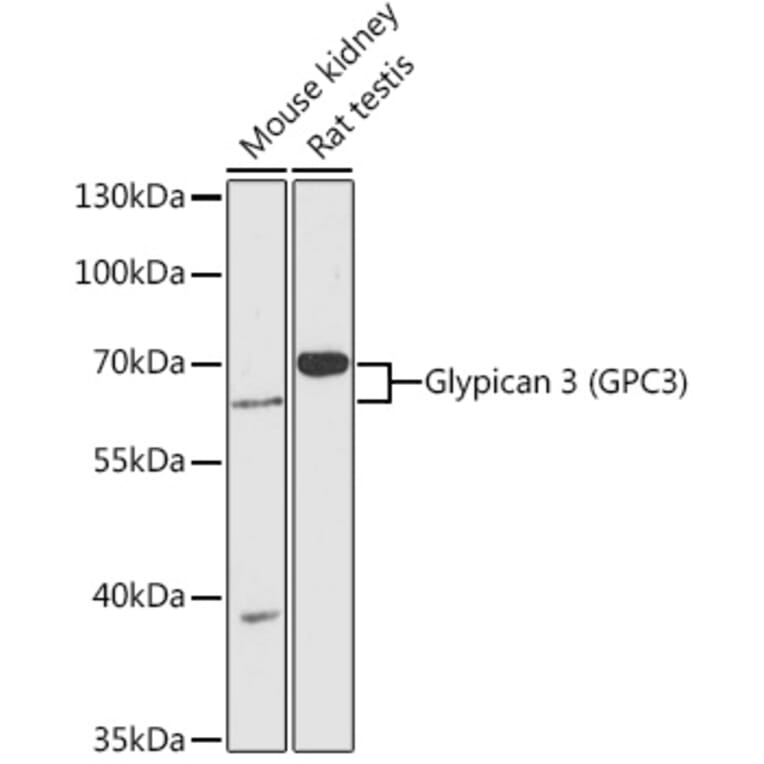 Western Blot - Anti-Glypican 3 Antibody (A90870) - Antibodies.com