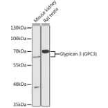 Western Blot - Anti-Glypican 3 Antibody (A90870) - Antibodies.com