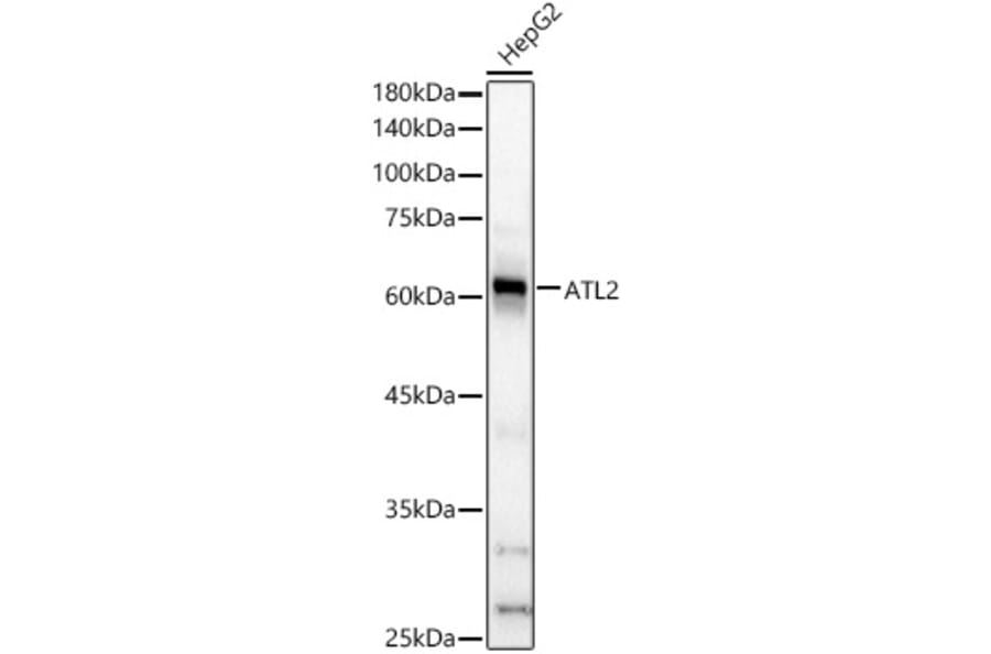Western Blot - Anti-ARL6IP2 Antibody (A90872) - Antibodies.com