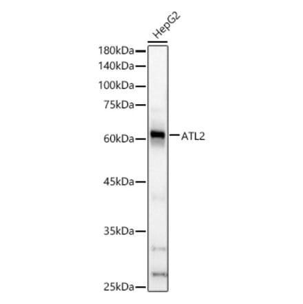 Western Blot - Anti-ARL6IP2 Antibody (A90872) - Antibodies.com