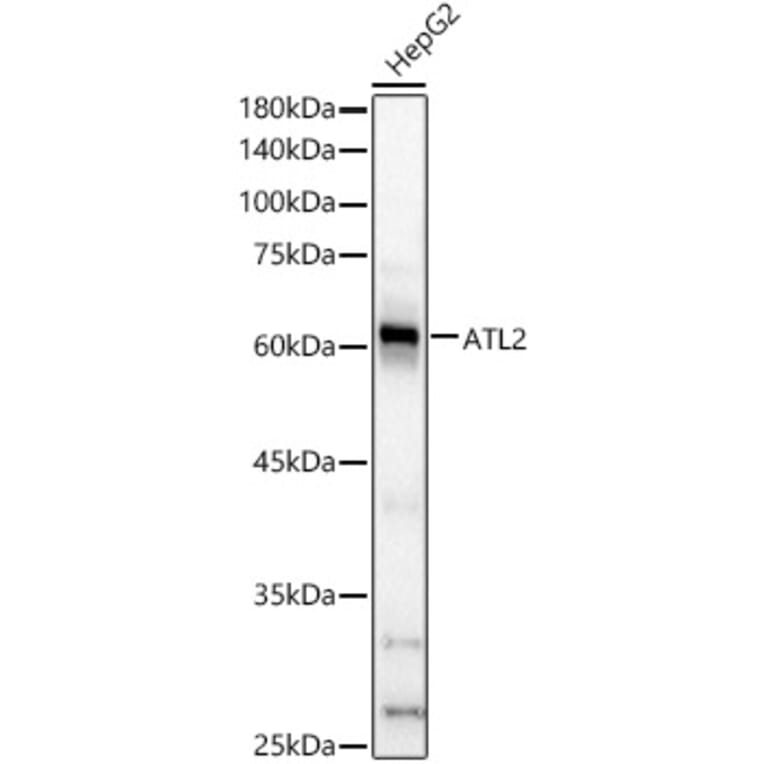 Western Blot - Anti-ARL6IP2 Antibody (A90872) - Antibodies.com
