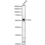 Western Blot - Anti-ARL6IP2 Antibody (A90872) - Antibodies.com