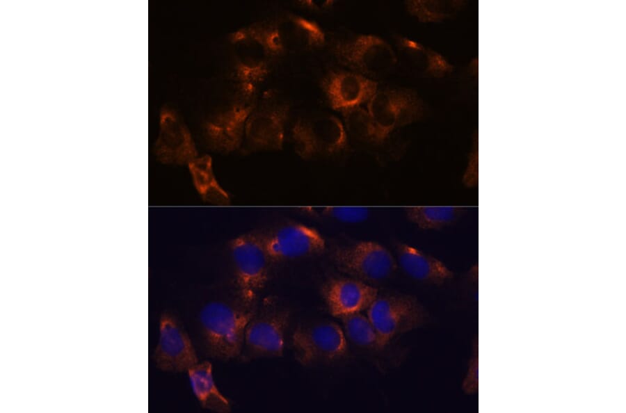 Immunofluorescence - Anti-ARL6IP2 Antibody (A90872) - Antibodies.com