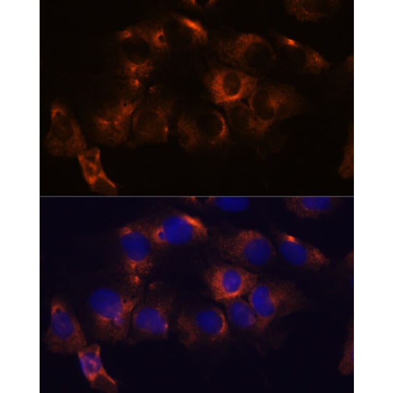 Immunofluorescence - Anti-ARL6IP2 Antibody (A90872) - Antibodies.com
