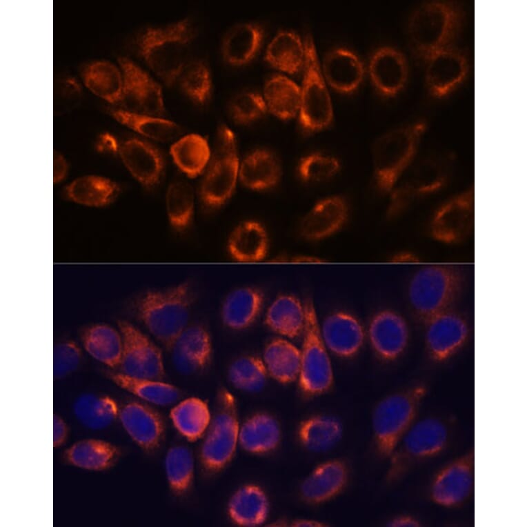 Immunofluorescence - Anti-ARL6IP2 Antibody (A90872) - Antibodies.com