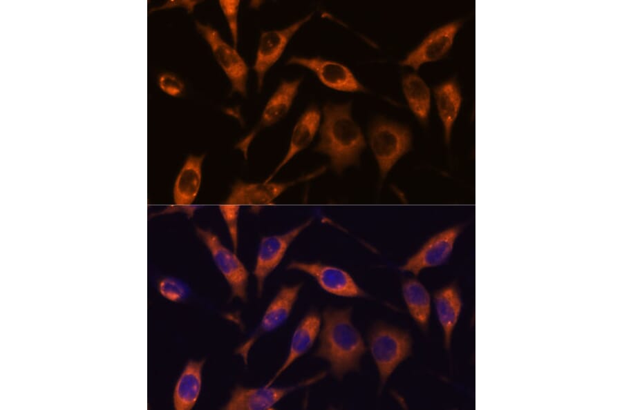 Immunofluorescence - Anti-ARL6IP2 Antibody (A90872) - Antibodies.com