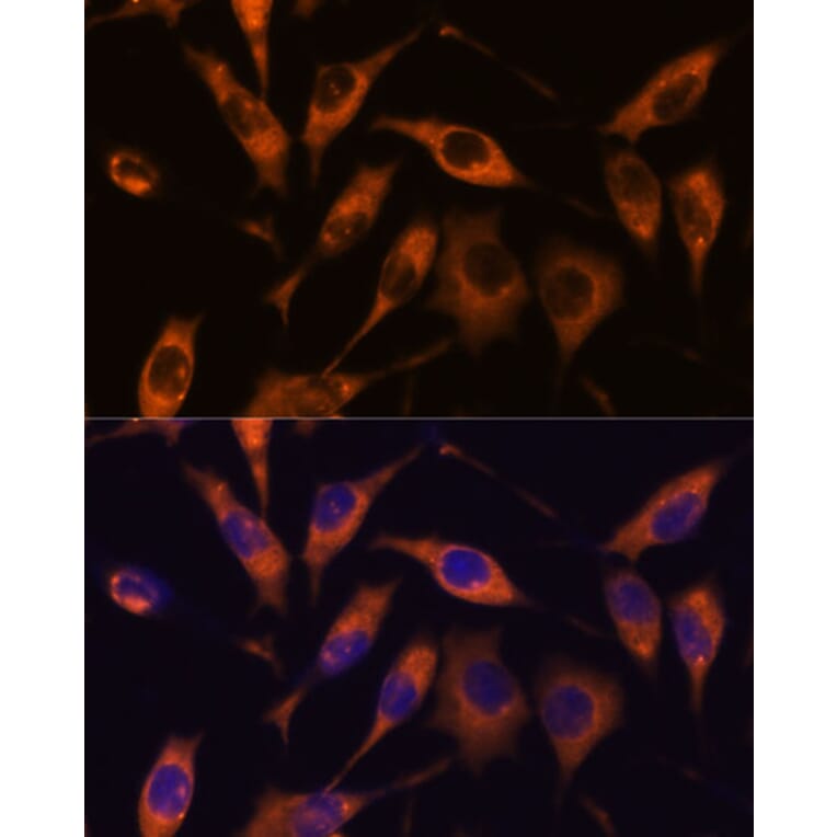 Immunofluorescence - Anti-ARL6IP2 Antibody (A90872) - Antibodies.com