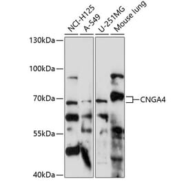 Western Blot - Anti-CNGA4 Antibody (A90873) - Antibodies.com