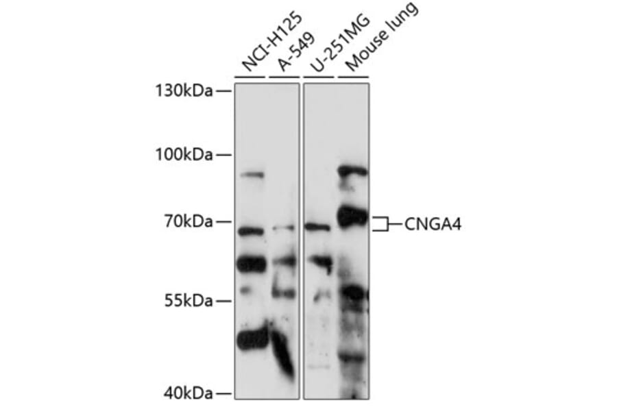 Western Blot - Anti-CNGA4 Antibody (A90873) - Antibodies.com