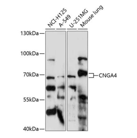 Western Blot - Anti-CNGA4 Antibody (A90873) - Antibodies.com