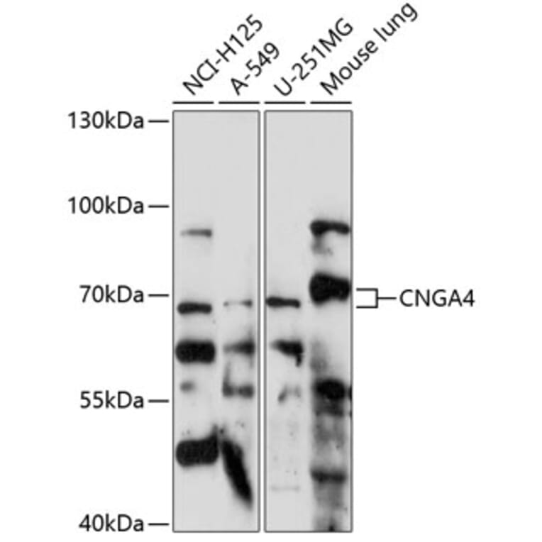 Western Blot - Anti-CNGA4 Antibody (A90873) - Antibodies.com