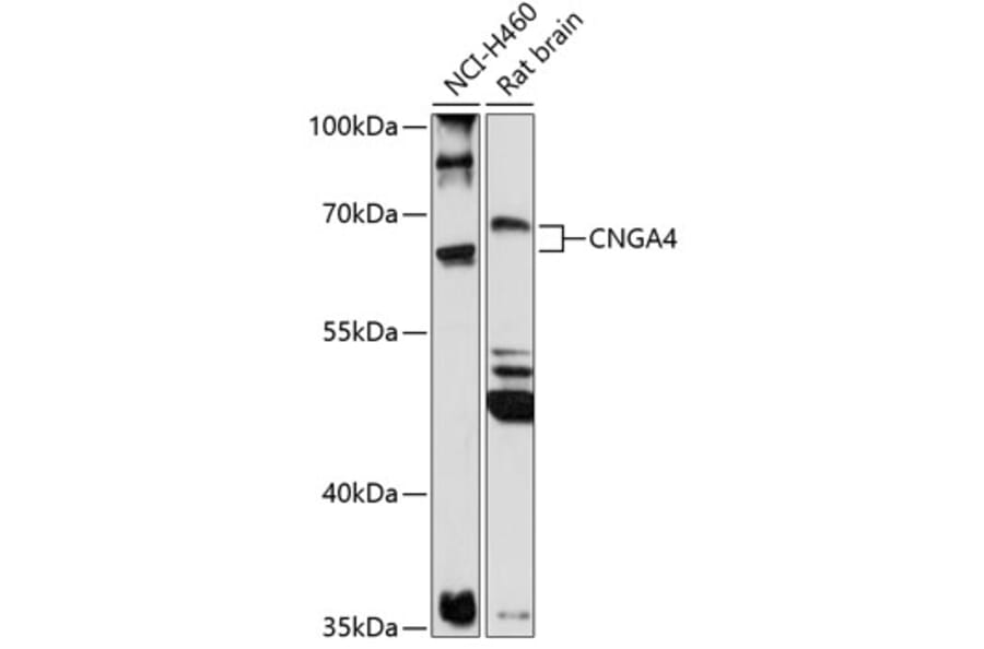 Western Blot - Anti-CNGA4 Antibody (A90874) - Antibodies.com