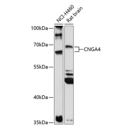 Western Blot - Anti-CNGA4 Antibody (A90874) - Antibodies.com