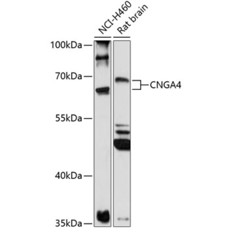 Western Blot - Anti-CNGA4 Antibody (A90874) - Antibodies.com