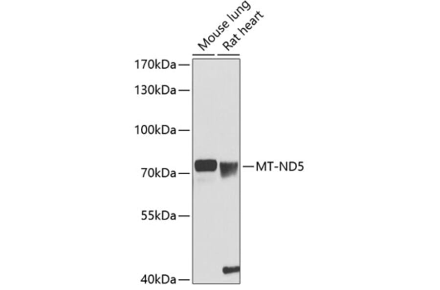 Western Blot - Anti-MT-ND5 Antibody (A90876) - Antibodies.com