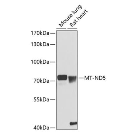 Western Blot - Anti-MT-ND5 Antibody (A90876) - Antibodies.com