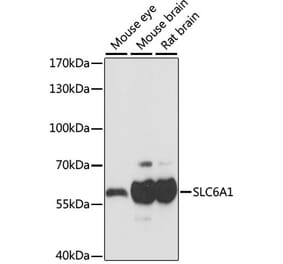 Western Blot - Anti-GABA Transporter 1 / GAT 1 Antibody (A90877) - Antibodies.com