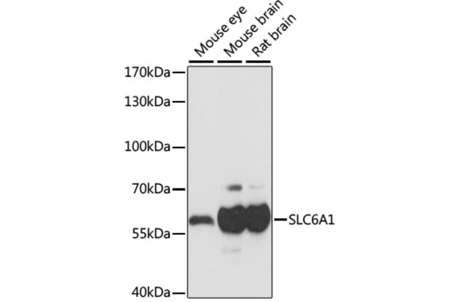 Western Blot - Anti-GABA Transporter 1/GAT 1 Antibody (A90877) - Antibodies.com
