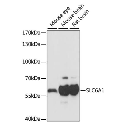 Western Blot - Anti-GABA Transporter 1 / GAT 1 Antibody (A90877) - Antibodies.com