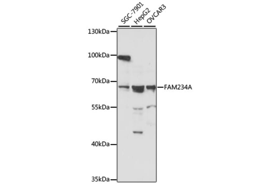 Western Blot - Anti-FAM234A Antibody (A90878) - Antibodies.com