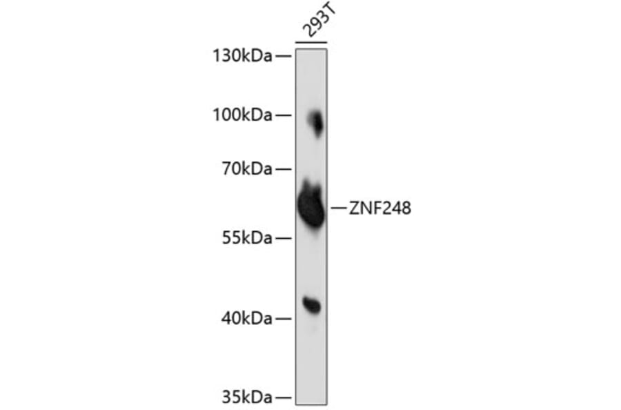 Western Blot - Anti-ZNF248 Antibody (A90879) - Antibodies.com