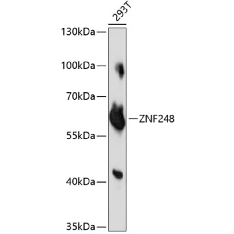 Western Blot - Anti-ZNF248 Antibody (A90879) - Antibodies.com