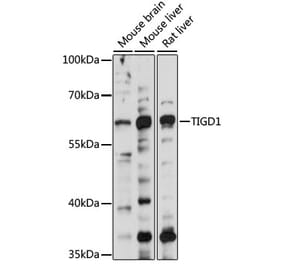 Western Blot - Anti-TIGD1 Antibody (A90880) - Antibodies.com