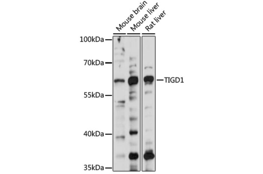 Western Blot - Anti-TIGD1 Antibody (A90880) - Antibodies.com